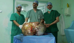 Ալժիրցի բժիշկները հեռացրել են հիվանդի ձվարանների 37 կգ հսկայական ուռուցքը